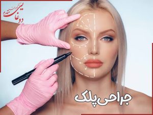 جراحی پلک در تهران - دکتر مهران دوغایی
