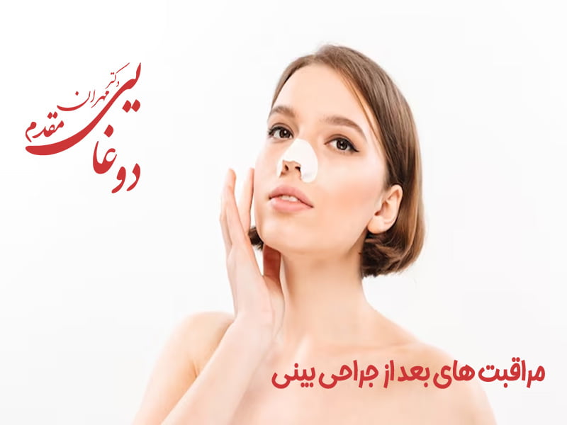راهنما مراقبت های بعد از جراحی بینی در تهران - دکتر دوغایی مقدم