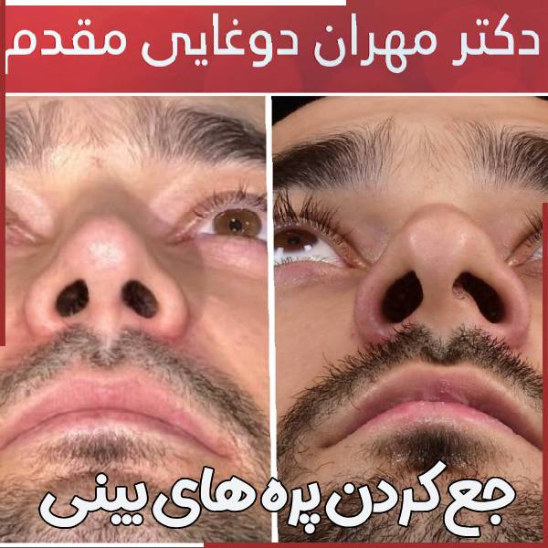 عمل جمع کردن پره های بنیی