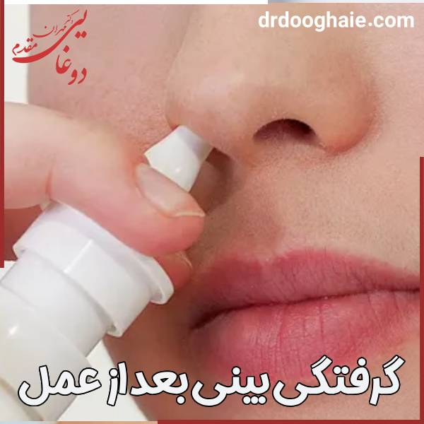 درمن گرفتگی بینی بعد از جراحی