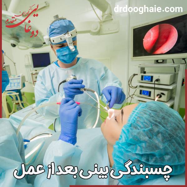 چسبندگی بینی بعد از جراحی