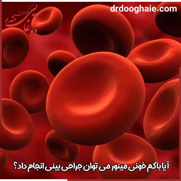عمل بینی در کم خونی مینور