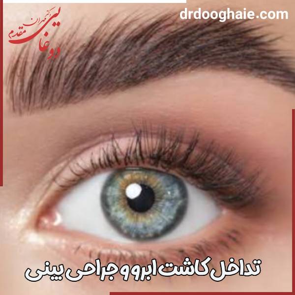 کاشت ابرو و عمل بینی